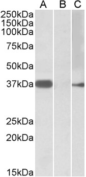 Anti-MYF6 Antibody - Identical to Abcam (ab106253) and Novus (NBP1-52030)