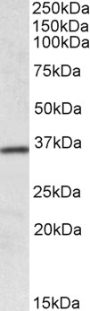 Anti-HOXA4 Antibody - Identical to Abcam (ab106763) and Novus (NBP1-52039)