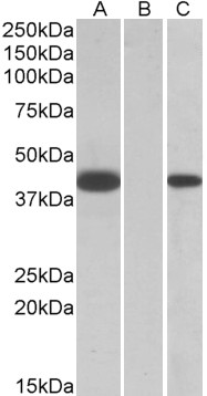 Anti-FANCF Antibody - Identical to Novus (NBP1-52057)