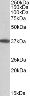 Anti-MOGAT2 Antibody - Identical to Abcam (ab106247) and Novus (NBP1-52078)