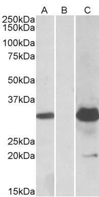 Anti-KCTD11 Antibody - Identical to Novus (NBP1-72049)