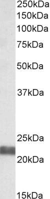 Anti-UBE2F Antibody - Identical to Abcam (ab113415)