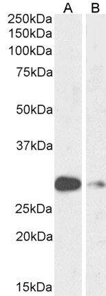 Anti-ASCL1 Antibody - Identical to Abcam (ab223229)