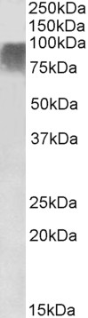 Anti-PRDM9 Antibody - Identical to Abcam (ab178531)