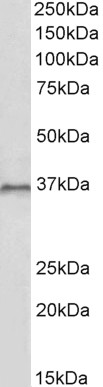 Anti-HOXC10 Antibody - Identical to Abcam (ab181487)