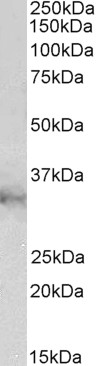 Anti-CLIC1 Antibody - Identical to Abcam (ab219265)