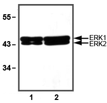 Anti-ERK1 + ERK2 Antibody [E31R]