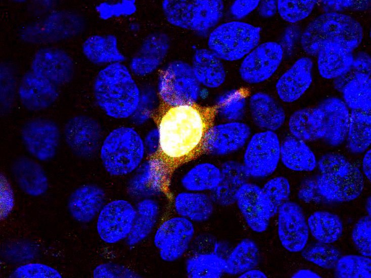 Anti-CRISPR-Cas9 Antibody [3F9]