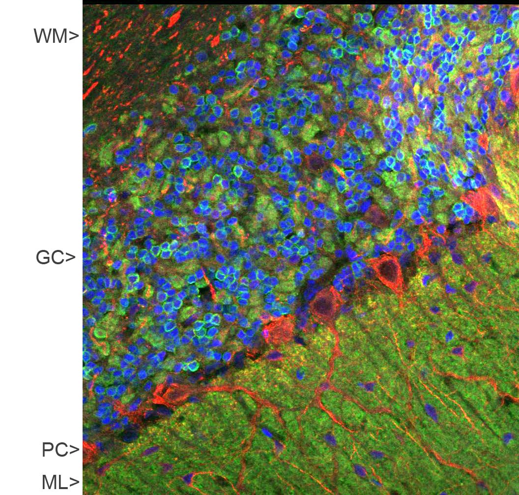 Anti-Visinin Like Protein 1 Antibody