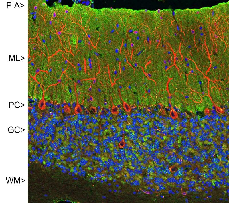 Anti-Visinin Like Protein 1 Antibody [2D11]