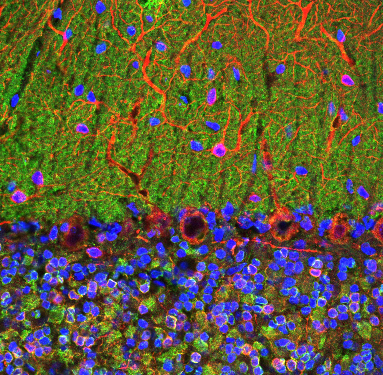 Anti-Visinin Like Protein 1 Antibody [3A9]