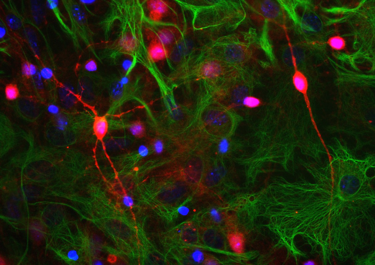 Anti-Visinin Like Protein 1 Antibody