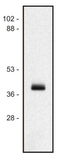 Anti-HLA Class I Antibody [MEM-147]