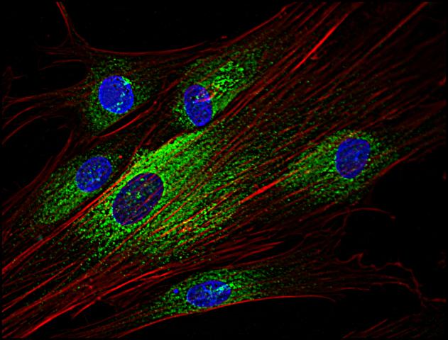 Anti-SYK Antibody [SYK-01] - Identical to Abcam (ab3993)