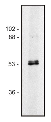 Anti-alpha Tubulin + beta Tubulin Antibody [TU-10]