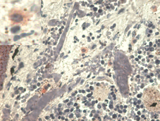 Anti-HLA G Antibody [MEM-G/1] - Identical to Abcam (ab7759)