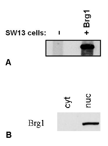 Anti-BRG1 Antibody [BRG-01]