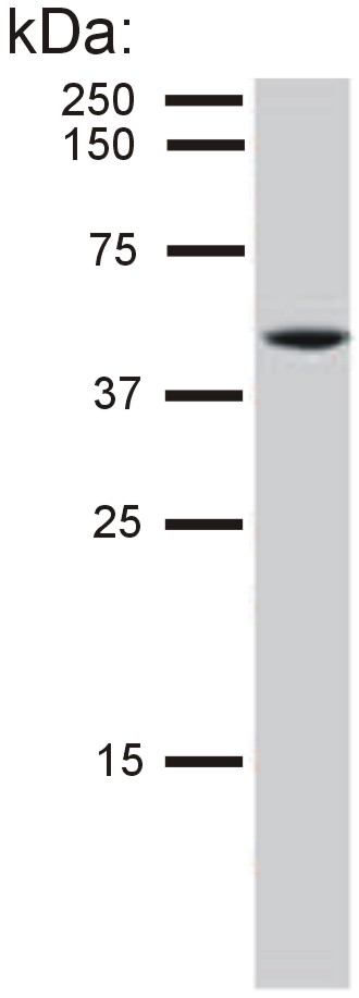 Anti-Cytokeratin 8 Antibody [C-51]