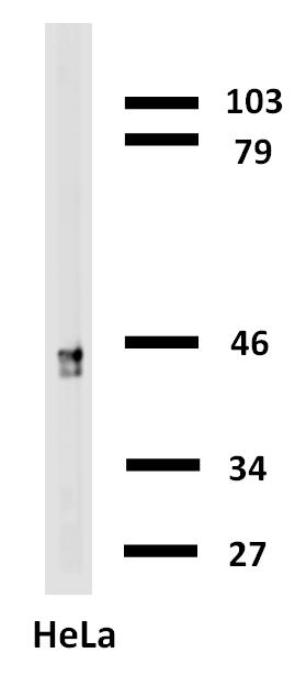 Anti-Cytokeratin 18 Antibody [C-04] (Biotin)