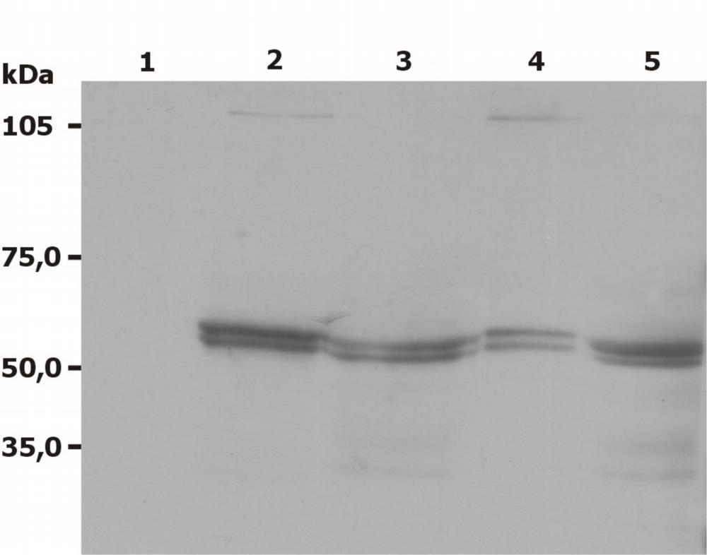 Anti-LYN Antibody [LYN-01] - Identical to Abcam (ab1890)