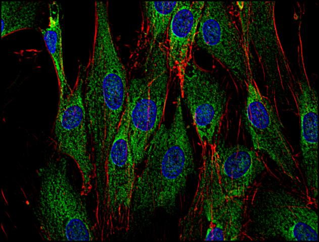 Anti-SOS1 Antibody [SOS-01]