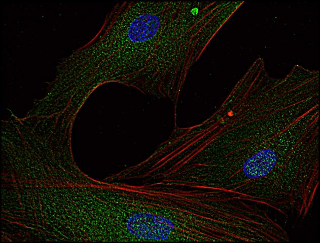 Anti-FYN Antibody [FYN-01] - Identical to Abcam (ab1881)