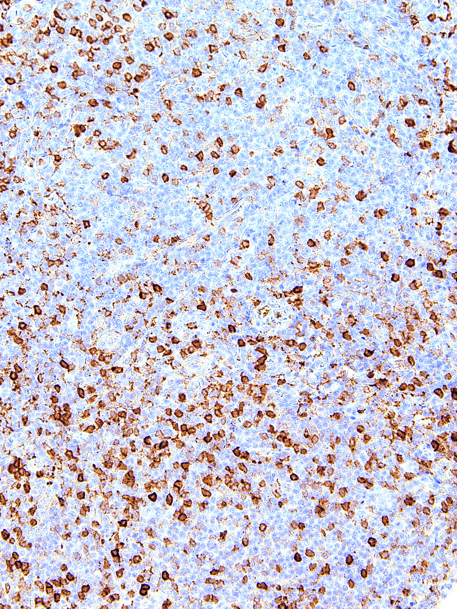 Anti-Annexin A1 Antibody [IHC512]