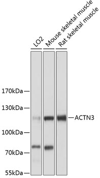 Anti-ACTN3 Antibody