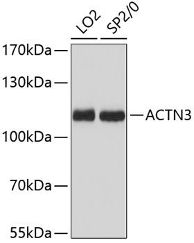 Anti-ACTN3 Antibody