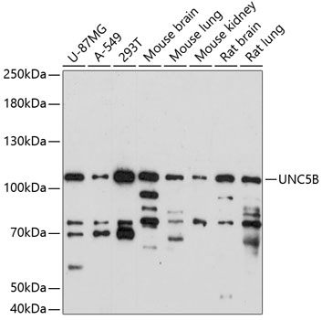 Anti-UNC5B Antibody