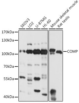 Anti-COMP / Cartilage oligomeric matrix protein Antibody