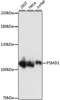Anti-PSMD1 Antibody