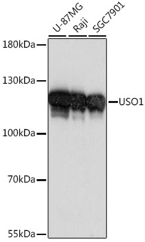 Anti-USO1 Antibody
