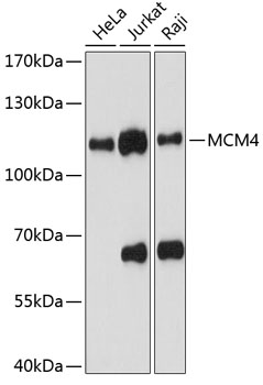 Anti-MCM4 Antibody