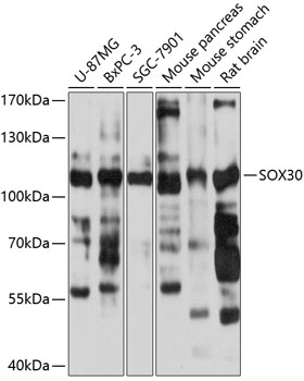 Anti-Sox30 Antibody