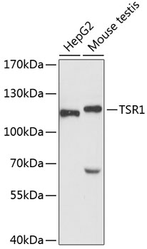 Anti-TSR1 Antibody