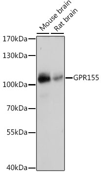 Anti-GPR155 Antibody
