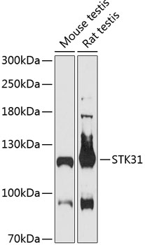 Anti-STK31 Antibody