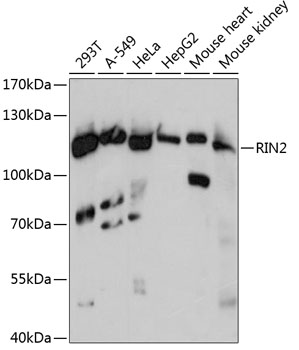Anti-RIN2 Antibody