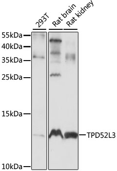 Anti-TPD52L3 Antibody