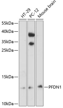 Anti-PFDN1 Antibody