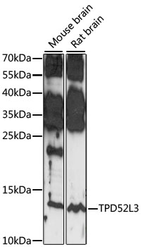 Anti-TPD52L3 Antibody