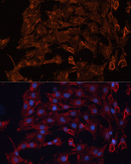 Anti-ABCB11 / BSEP Antibody