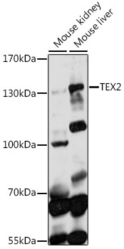 Anti-TEX2 Antibody