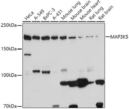 Anti-ASK1 Antibody