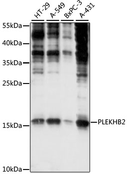 Anti-PLEKHB2 Antibody