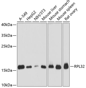 Anti-RPL32 Antibody
