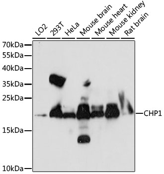 Anti-Calcium binding protein P22 Antibody