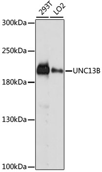 Anti-UNC13B Antibody