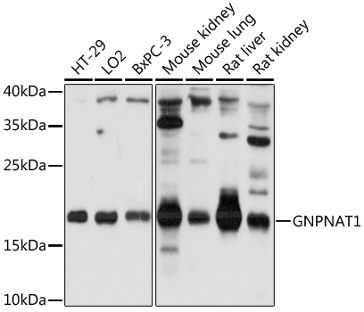Anti-GNPNAT1 Antibody